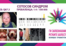 Сотосов синдром